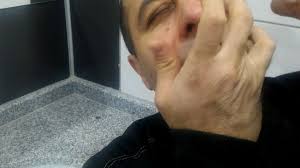 Gulme Garantili Goze Limon Sikma Youtube