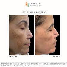 Northstar Dermatology