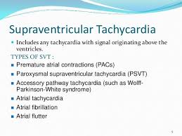 Pin By Nonas Arc On Supraventricular Tachycardia Svt Svt Heart Condition Nursing Memes Svt Heart