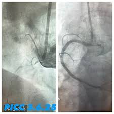 Atish Pratap Mathur MD MRCP MPH FACC FSCAI