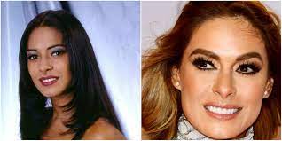 Una cosa es lo que tú creas y otra es estar. Cirugias De Galilea Montijo Antes Y Despues Cirugias De