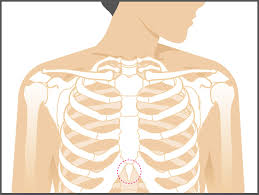 Under your left rib cage. Xiphoid Process Pain Lump Removal And More