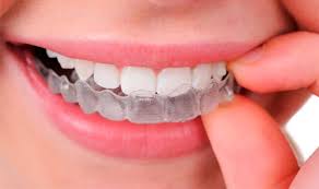 Place it in the mouth against the upper set of teeth, gently push it with your fingers to form a mold against the molars. How To Mold A Perfect Mouthguard Step By Step Guide With Video Explanation 2021