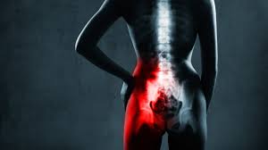 Sacroiliac joint is a frequent cause of low back pain and may even be the most common factor in the symptoms of back pain emanating from the sacroiliac joint are difficult to distinguish from other if your medical doctor feels that your back pain is coming from sacroiliac joint, you will likely be. Sacroiliac Joint Pain Relief National Spine Pain Centers