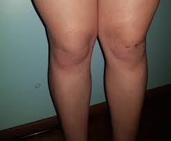 Transex de caxias