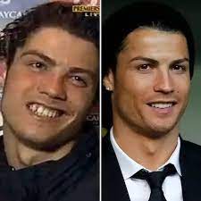 'so happy to be able. Cristiano Ronaldo Did Not Have His Nice Teeth Before He Became Famous What Did He Do To His Teeth Quora