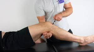 Image result for Reflex Exam