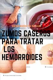 También se denomina así al propio proceso patológico, en el cual, un agregado de plaquetas o fibrina obstruye un vaso sanguíneo. Que Es Trombosis Hemorroidal Externa Hemorroides Trombosadas Con Trombos