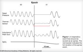 What Do Ahi Rera Arousal And Rdi Mean Advanced Sleep