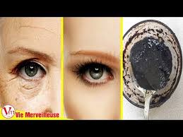Epingle Sur Astuces Sante