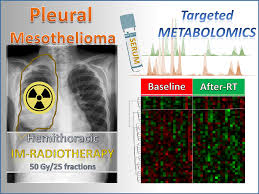 Surgery for mesothelioma after radiation therapy (smart). Cancers Free Full Text Radical Hemithoracic Radiotherapy Induces Systemic Metabolomics Changes That Are Associated With The Clinical Outcome Of Malignant Pleural Mesothelioma Patients Html