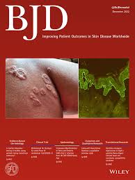 Image result for Smodingium