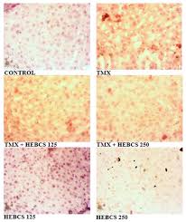 Image result for Buchholzia