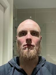 Quelle pilosité faciale avez-vous ? : r/bald