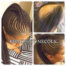 14 Extraordinary Alopecia Camouflage Cornrows By Braids By Necole Hair Styles Kids Braided Hairstyles Alopecia Hairstyles
