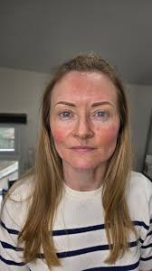 CLINICARE PURE PEEL 𝐂𝐇𝐄𝐌𝐈𝐂𝐀𝐋 𝐩𝐞𝐞𝐥𝐬 𝐝𝐨𝐧𝐭 𝐣𝐮𝐬𝐭  𝐬𝐭𝐫𝐢𝐩 𝐚𝐰𝐚𝐲 𝐝𝐞𝐚𝐝 𝐬𝐤𝐢𝐧 𝐜𝐞𝐥𝐥𝐬 𝐫𝐞𝐯𝐞𝐚𝐥𝐢𝐧𝐠 𝐍𝐞𝐰  𝐛𝐫𝐢𝐠𝐡𝐭𝐞𝐫 𝐬𝐤𝐢𝐧 𝐓𝐡𝐞𝐲 𝐚𝐫𝐞 𝐟𝐚𝐧𝐭𝐚𝐬𝐭𝐢𝐜 𝐟𝐨𝐫  𝐭𝐫𝐞𝐚𝐭𝐢𝐧𝐠 𝐚𝐜𝐧𝐞 𝐏𝐔𝐑𝐄 𝐩𝐞𝐞𝐥 ...