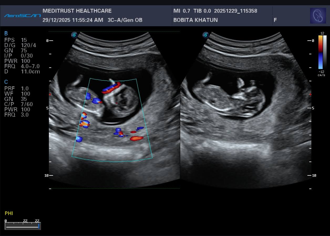USG Lower Abdomen/Obstetrics product image