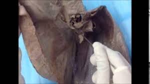 Áspero, rugoso) es un órgano del aparato respiratorio de carácter cartilaginoso y membranoso que va desde la laringe a los bronquios. Descripcion Anatomica De Lengua Laringe Faringe Traquea Pericadio Y Diafragma Youtube