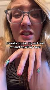 100/10 do not recommend crushing your finger in your car door. #clumsylife  #nails #nailfail #brokennail #fy #fypage #manicure💅 #fypシ゚viral #ouch #fail