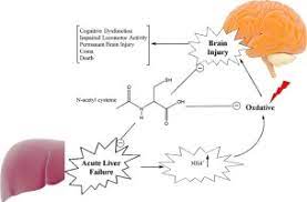 N Acetylcysteine Treatment Blunts Liver Failure Associated Impairment Of Locomotor Activity Sciencedirect