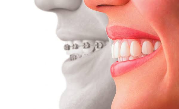Orthodontics Wakad