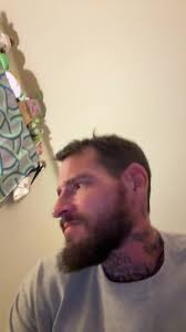 Carl Roepke Teeth Before and After