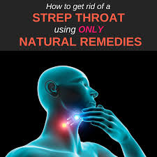 Strep Throat Is Caused By Bacteria From The A Streptococcus Group The Infection Affects The T Strep Throat Remedies Natural Strep Throat Strep Throat Remedies