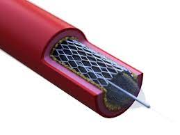 La vie quotidienne après un pontage ou la pose d'un stent dépend de la procédure et du patient. Angioplastie Stent Duree Principes Convalescence