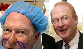 Hey Hey It's Saturday star John Blackman, 72, undergoes more facial surgery  after cancer battle