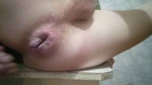 Un joven juega en una webcam con sus hemorroides y muestra su agujero roto