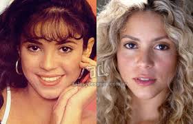 See more ideas about nose job, rhinoplasty, nose surgery. Shakira Before And After Nose Job Surgery Bad News With Shakira Before And When Rhinoplasty Surgery The Colombian Fashionable Singer Showed Her New Confidence In Color Pink Two Piece In Hawaii