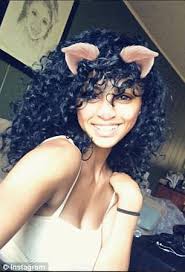 Chicago model with one foot shows off disabilities online