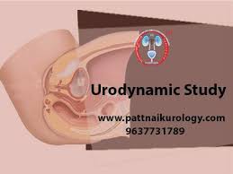 Pin On Urodynamic Study