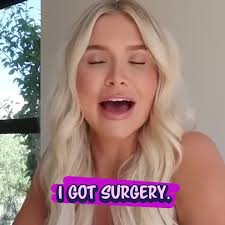 Alyssa from Alyssa and Charles Before and After