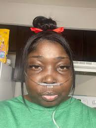 Support and Advice for Kidney Failure