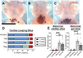 The Axenfeld-Rieger syndrome gene FOXC1 contributes to left-right  patterning