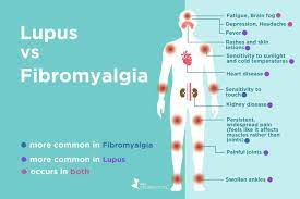Response to vitamin b12 and folic acid in myalgic encephalomyelitis and fibromyalgia. Fibromyalgia Vs Lupus What S The Difference