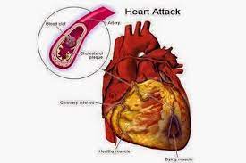 Drinking Water On Empty Stomach Heart Disease Symptoms Benefits Of Drinking Water Coronary Heart Disease