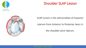 Image result for SLAP Lesion