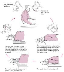 Thankfully, bppv is successfully treated with a series of exercises that your physical therapist will teach you. Benign Paroxysmal Positional Vertigo Ear Nose And Throat Disorders Merck Manuals Consumer Version