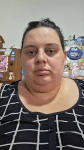 4to Día Después de la Cirugía Bariátrica