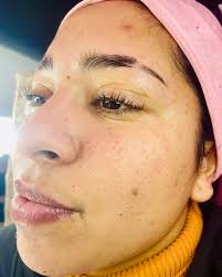 Depilacion Definitiva Láser ROMA (@roma_studiobeauty) • Instagram फ़ोटो और  वीडियो