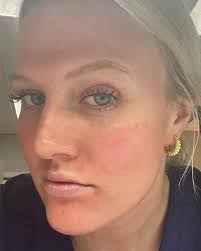 Libby Campbell (@aneumedspa_libby) • Instagram photos and videos