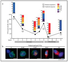 Furthermore, patients who do not have cancer cells spread to lungs or to liver can greatly survive. Cancers Free Full Text Cell Heterogeneity And Phenotypic Plasticity In Metastasis Formation The Case Of Colon Cancer Html