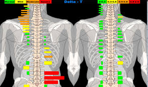 Tytron thermography scan display