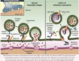 Infants may appear lethargic and limp. About Botulism Symptoms Of Botulism