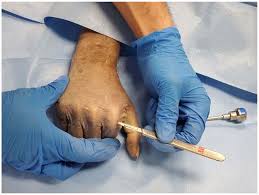 Image result for Traumatic Arthrotomy