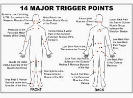 38 Conclusive Trigger Points Chart Free Download