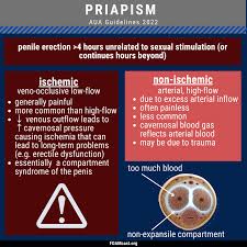 Image result for Priapism