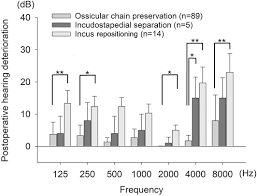 Image result for Ossicular Chain Disruption